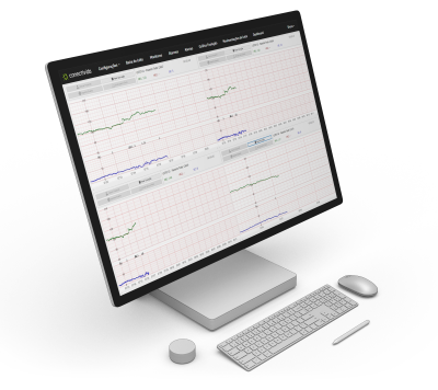 Monitor CTG Mockup